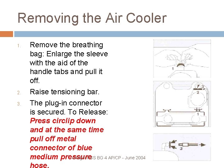 Removing the Air Cooler 1. 2. 3. Remove the breathing bag: Enlarge the sleeve