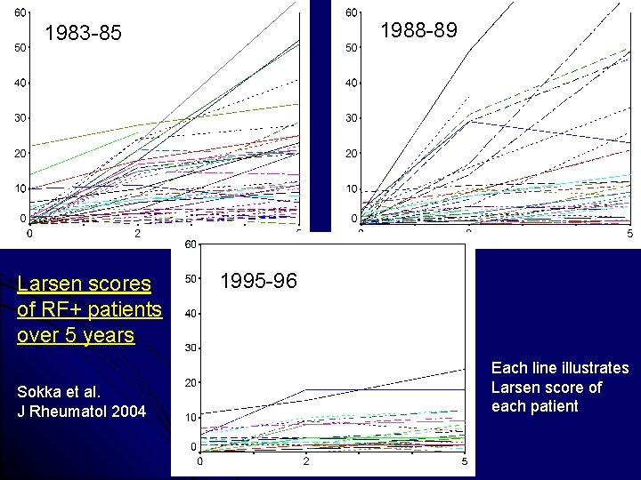 1988 -89 1983 -85 Larsen scores of RF+ patients over 5 years Sokka et
