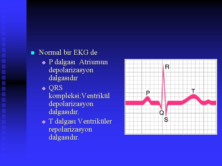 n Normal bir EKG de u P dalgası Atriumun depolarizasyon dalgasıdır u QRS kompleksi: