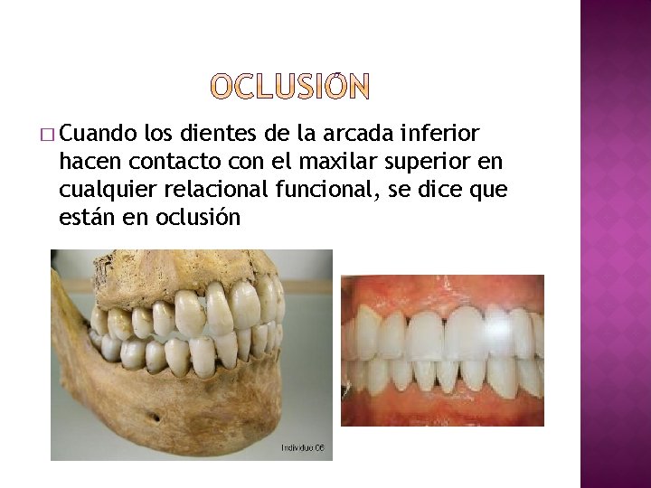 � Cuando los dientes de la arcada inferior hacen contacto con el maxilar superior