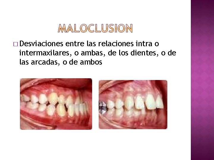 � Desviaciones entre las relaciones intra o intermaxilares, o ambas, de los dientes, o