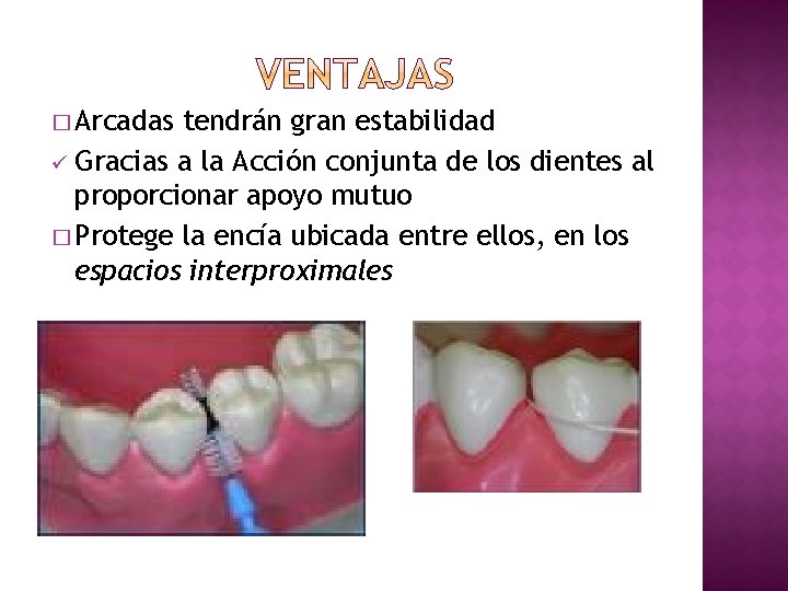 � Arcadas tendrán gran estabilidad ü Gracias a la Acción conjunta de los dientes