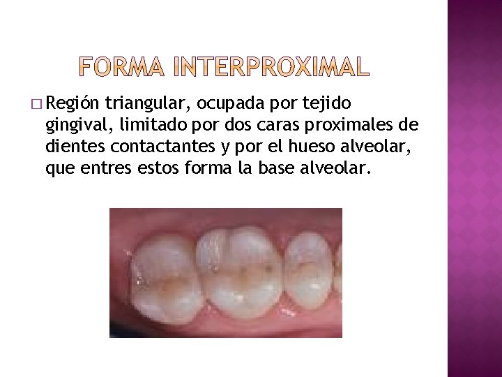 � Región triangular, ocupada por tejido gingival, limitado por dos caras proximales de dientes