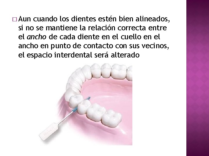 � Aun cuando los dientes estén bien alineados, si no se mantiene la relación