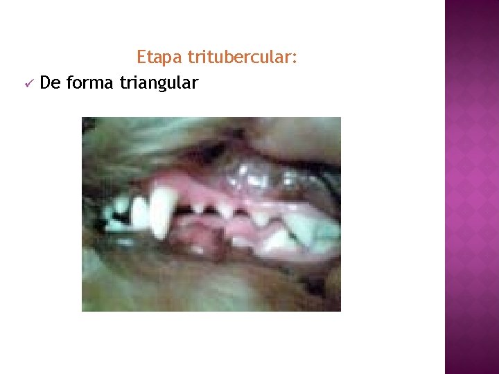 Etapa tritubercular: ü De forma triangular 