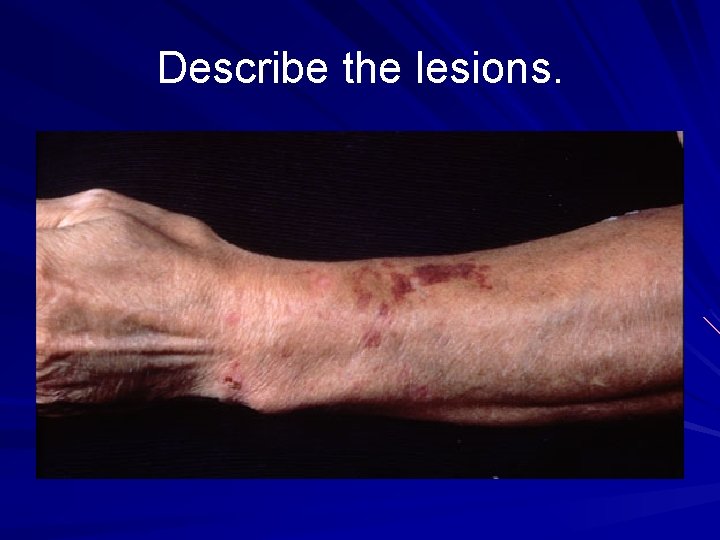 Describe the lesions. 