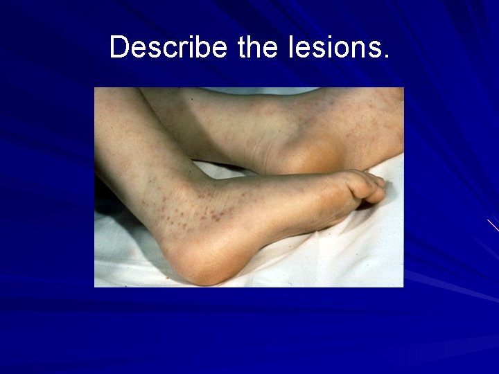 Describe the lesions. 