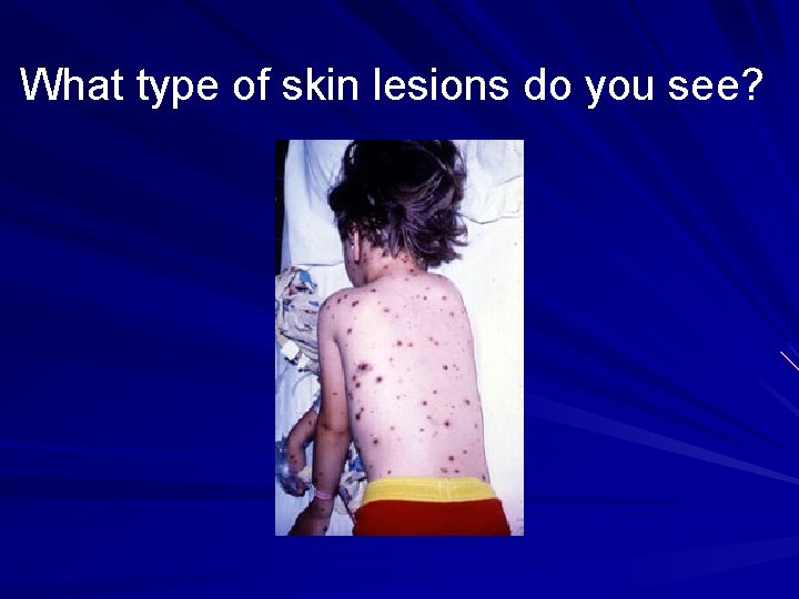 What type of skin lesions do you see? 