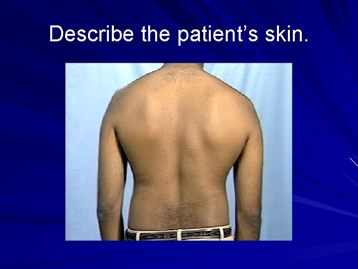 Describe the patient’s skin. 