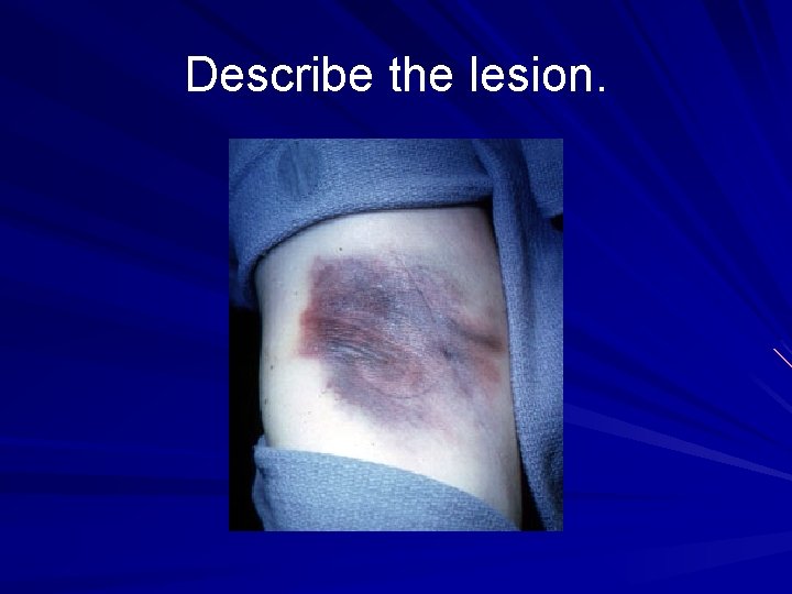 Describe the lesion. 