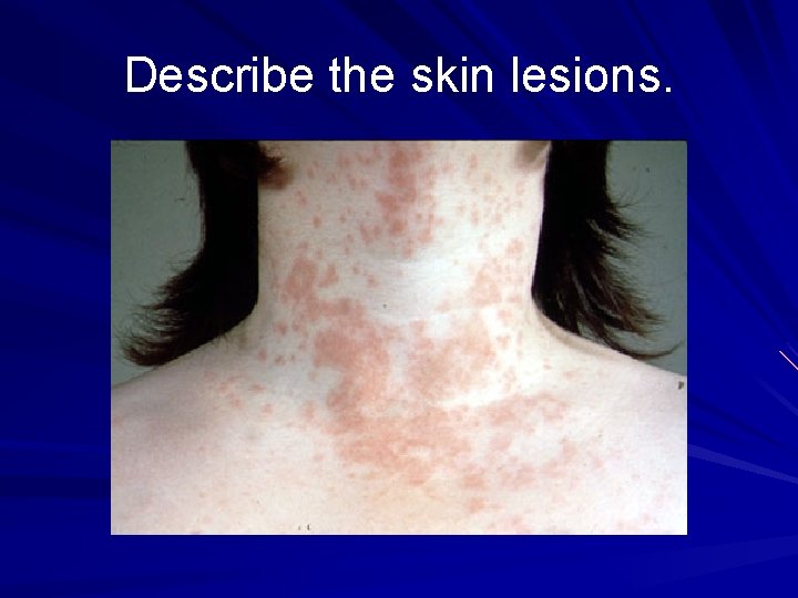 Describe the skin lesions. 