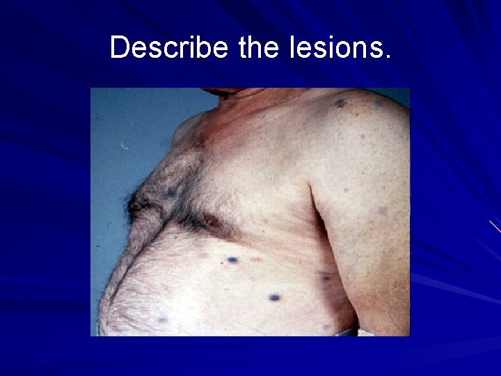 Describe the lesions. 