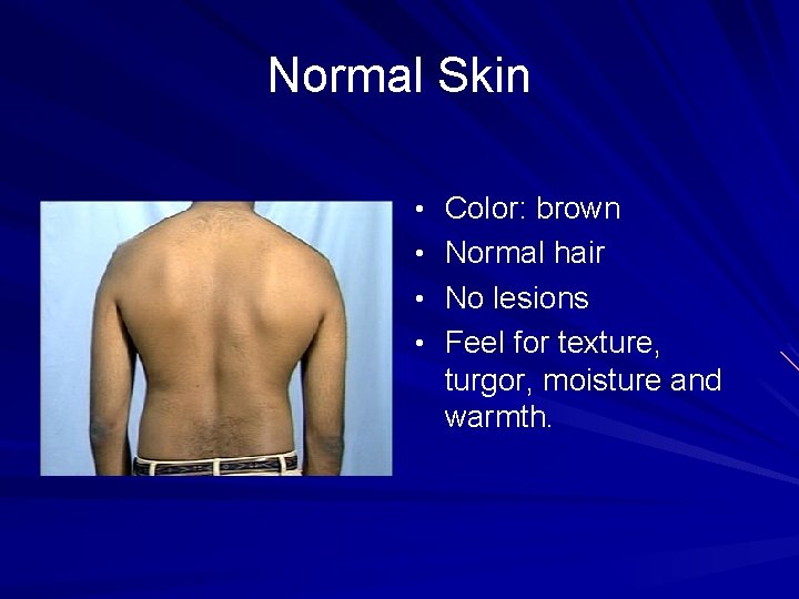 Normal Skin • Color: brown • Normal hair • No lesions • Feel for