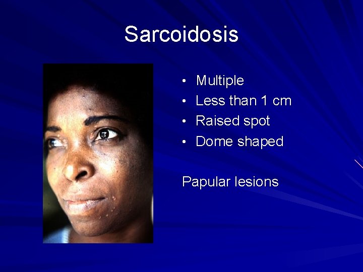 Sarcoidosis • Multiple • Less than 1 cm • Raised spot • Dome shaped