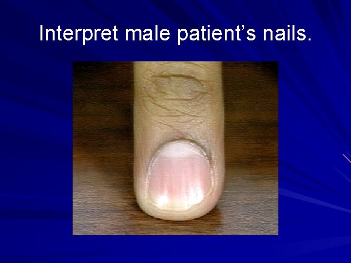 Interpret male patient’s nails. 