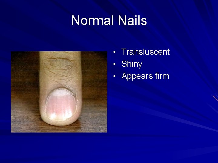 Normal Nails • Transluscent • Shiny • Appears firm 