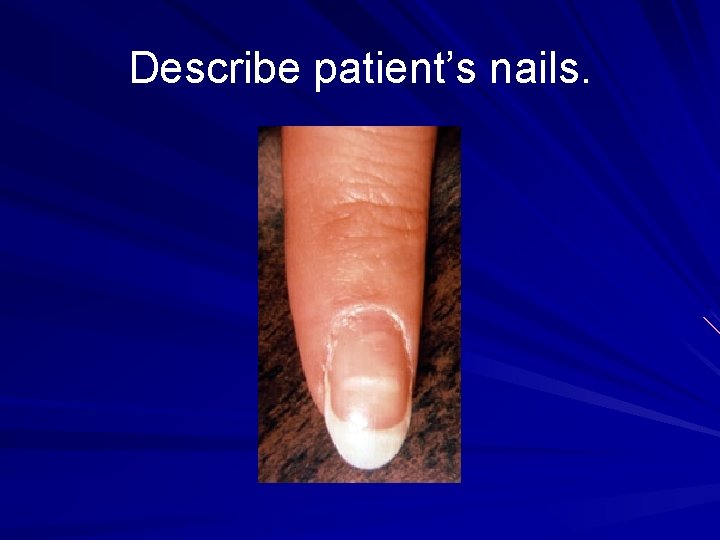 Describe patient’s nails. 
