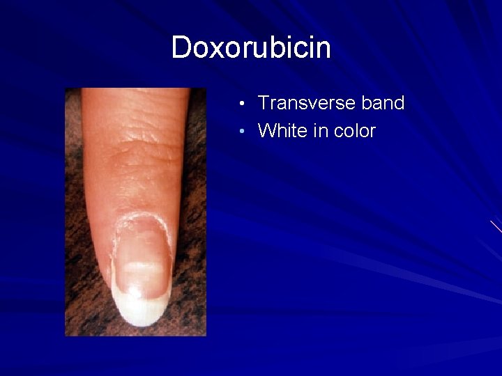 Doxorubicin • Transverse band • White in color 