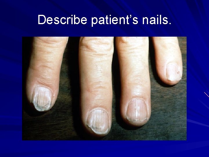 Describe patient’s nails. 