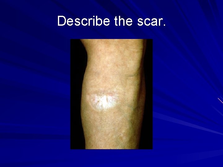 Describe the scar. 