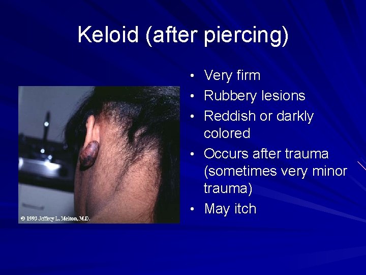 Keloid (after piercing) • Very firm • Rubbery lesions • Reddish or darkly colored