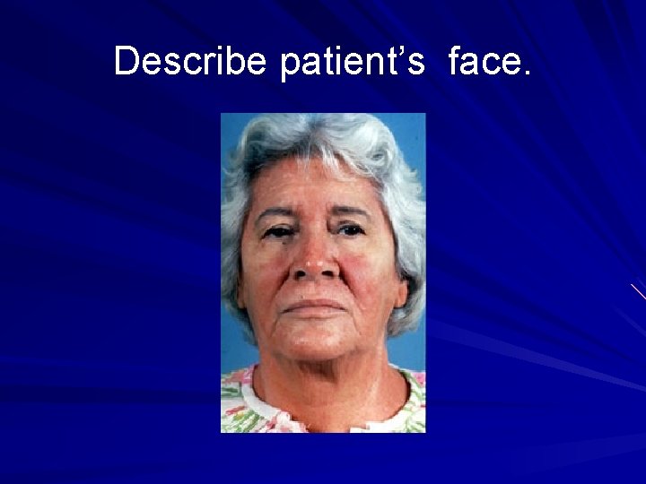 Describe patient’s face. 