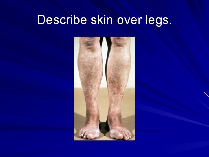 Describe skin over legs. 