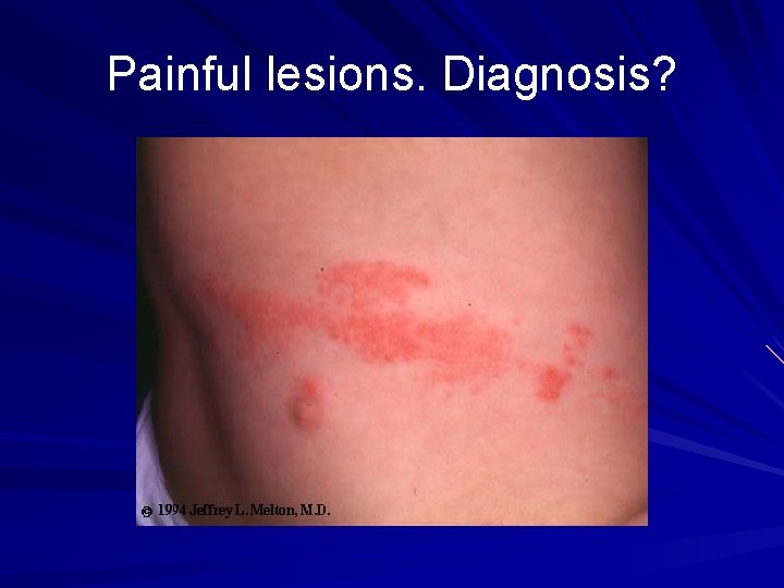 Painful lesions. Diagnosis? 