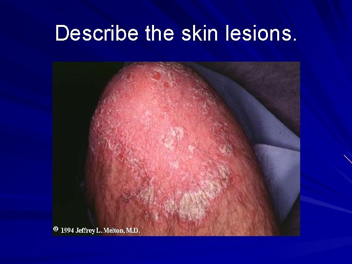 Describe the skin lesions. 