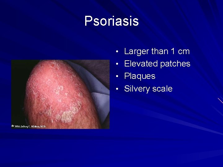 Psoriasis • Larger than 1 cm • Elevated patches • Plaques • Silvery scale