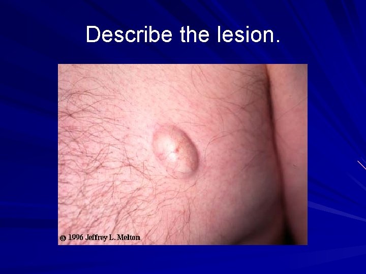Describe the lesion. 