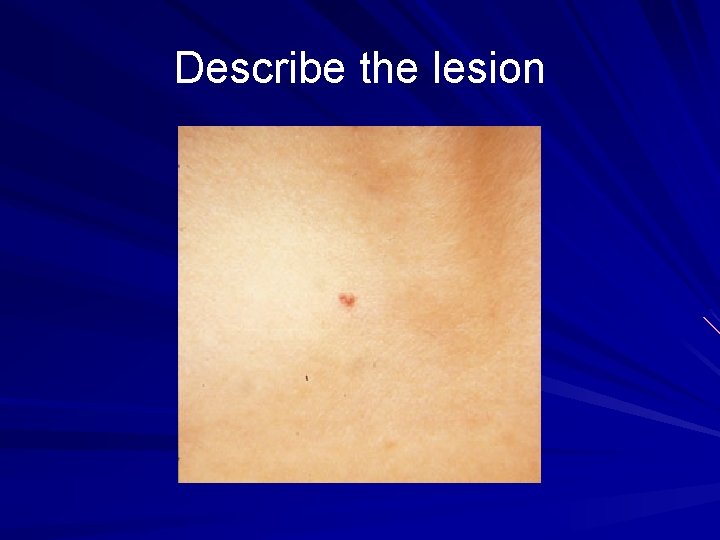 Describe the lesion 