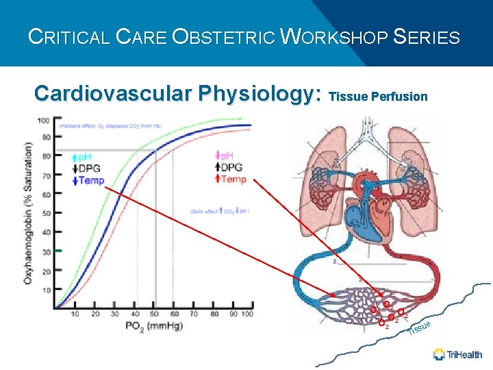 CRITICAL CARE OBSTETRIC WORKSHOP SERIES Cardiovascular Physiology: Tissue Perfusion O O 2 2 Tis