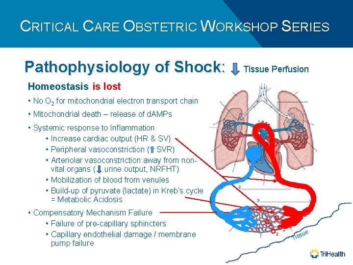 CRITICAL CARE OBSTETRIC WORKSHOP SERIES Pathophysiology of Shock: Tissue Perfusion Homeostasis is lost •