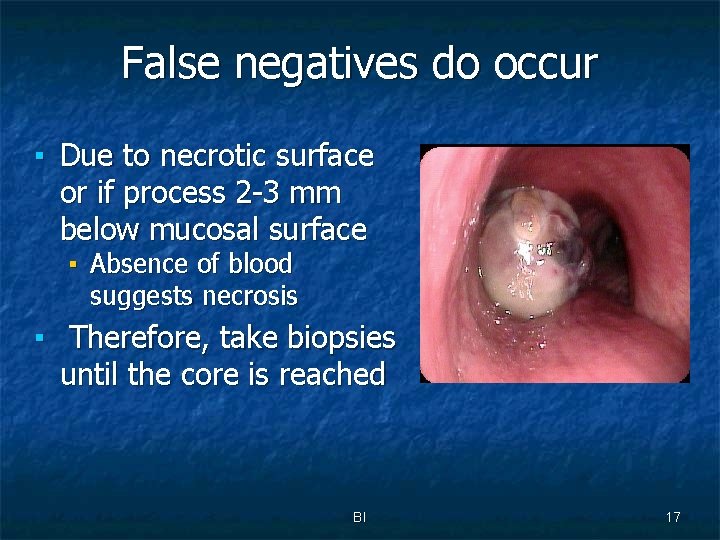 False negatives do occur ▪ Due to necrotic surface or if process 2 -3