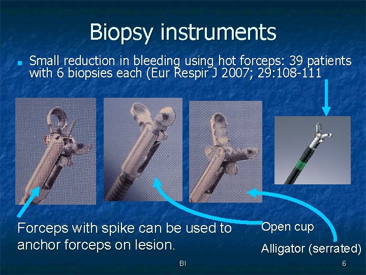 Biopsy instruments ■ Small reduction in bleeding using hot forceps: 39 patients with 6