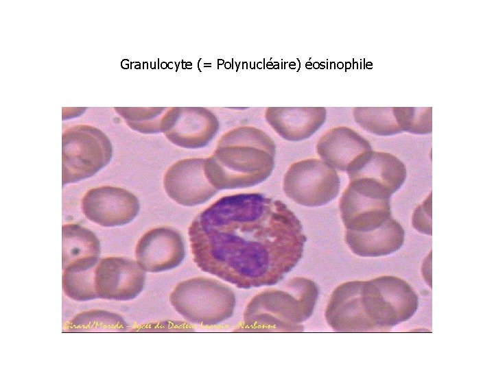 Granulocyte (= Polynucléaire) éosinophile 