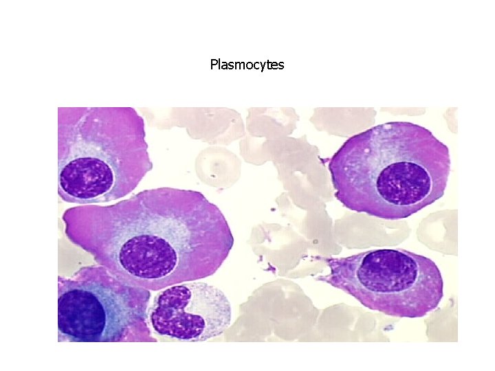 Plasmocytes 