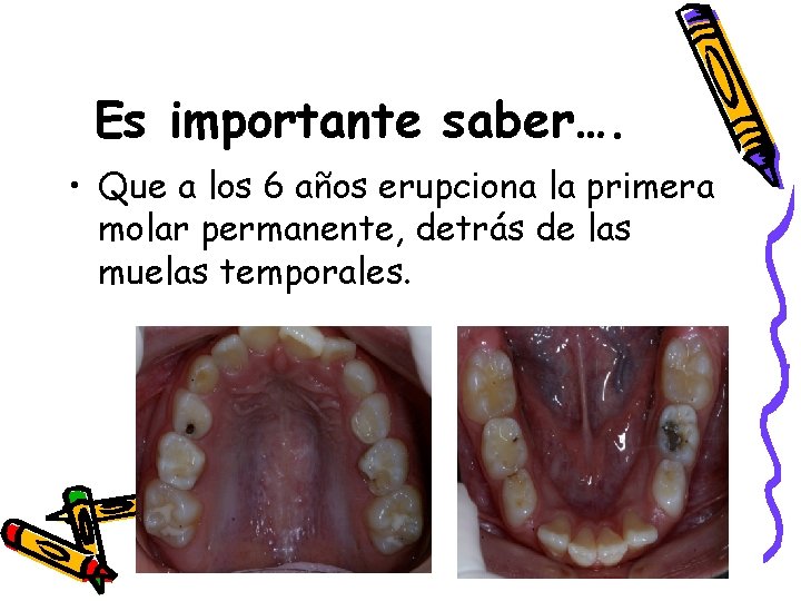 Es importante saber…. • Que a los 6 años erupciona la primera molar permanente,