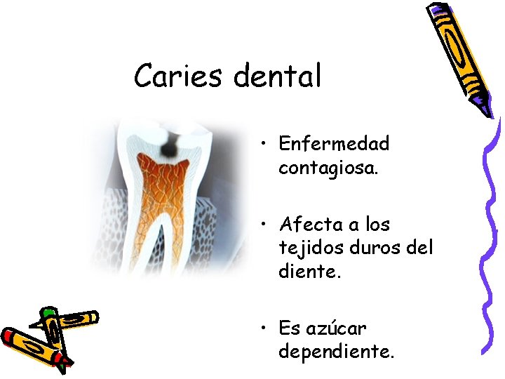 Caries dental • Enfermedad contagiosa. • Afecta a los tejidos duros del diente. •