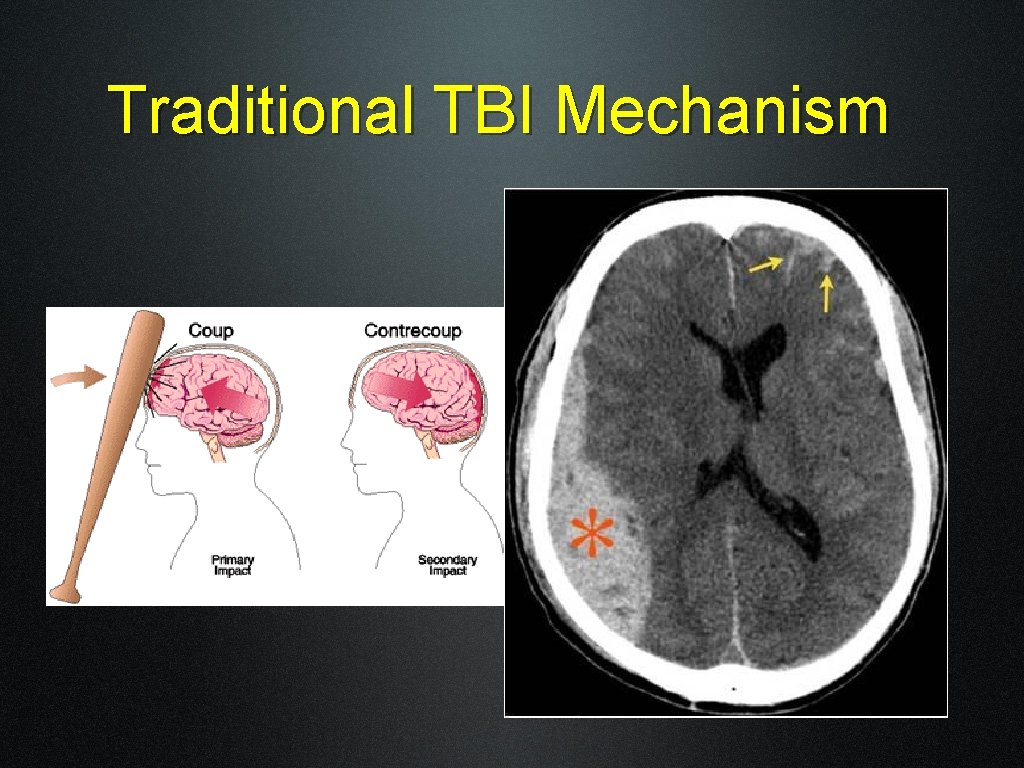 Traditional TBI Mechanism 