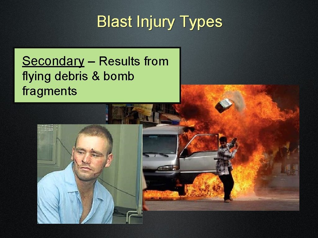 Blast Injury Types Secondary – Results from flying debris & bomb fragments 