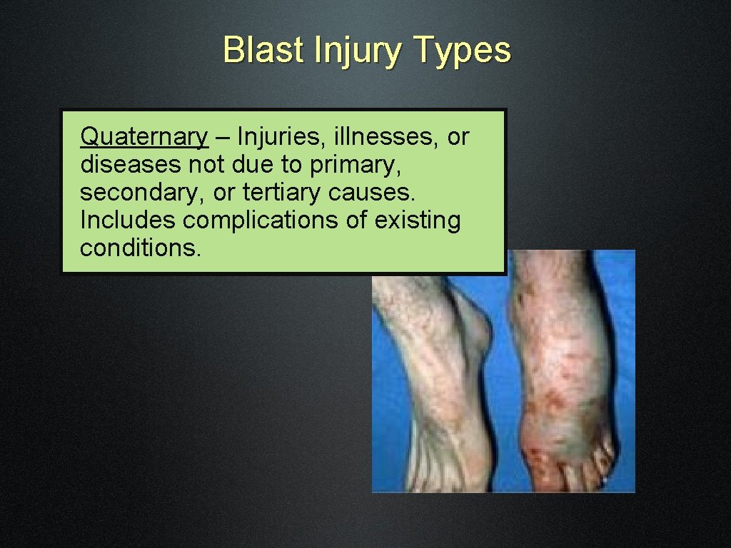 Blast Injury Types Quaternary – Injuries, illnesses, or diseases not due to primary, secondary,