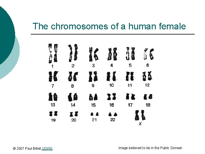 The chromosomes of a human female © 2007 Paul Billiet ODWS Image believed to