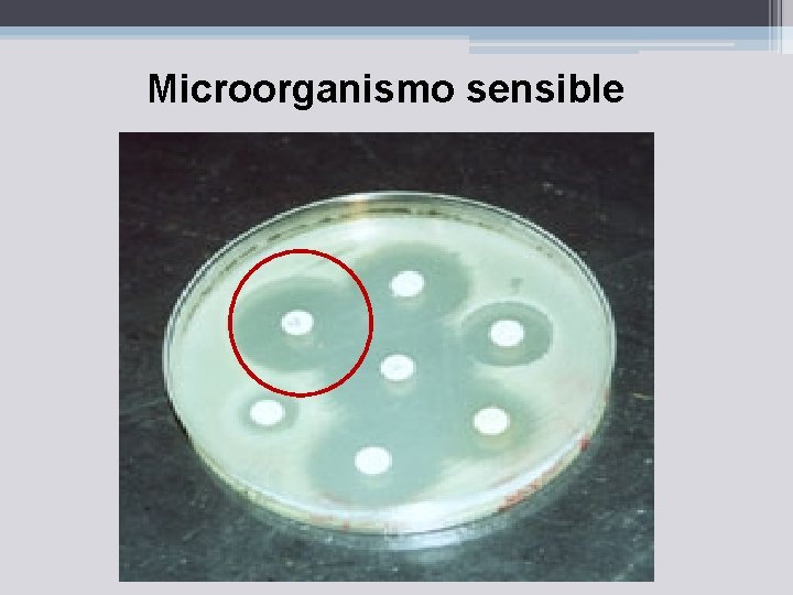 Microorganismo sensible 