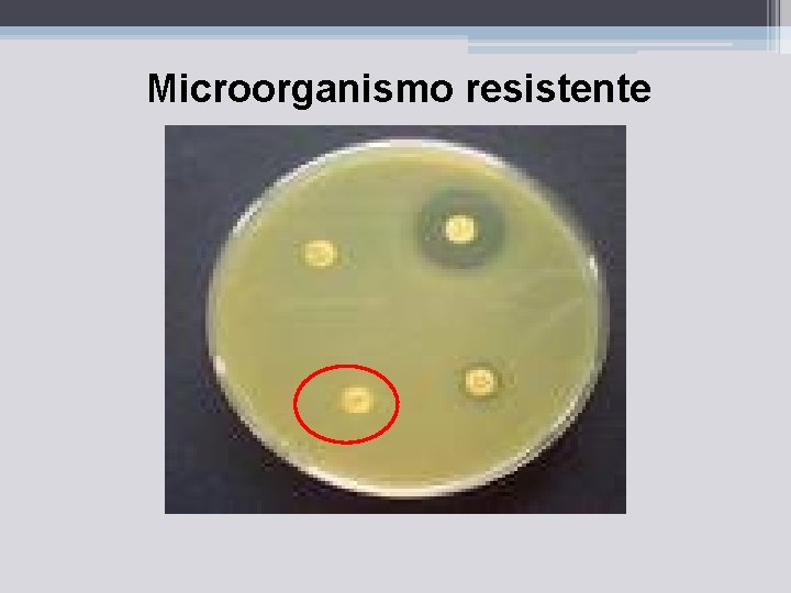 Microorganismo resistente 