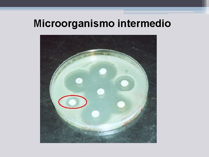 Microorganismo intermedio 