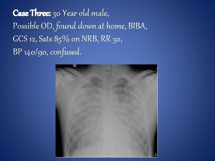 Case Three: 30 Year old male, Possible OD, found down at home, BIBA, GCS