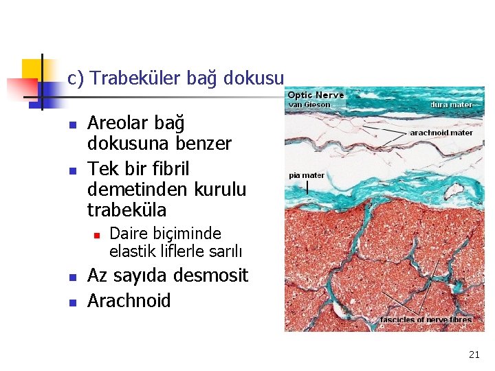 c) Trabeküler bağ dokusu n n Areolar bağ dokusuna benzer Tek bir fibril demetinden