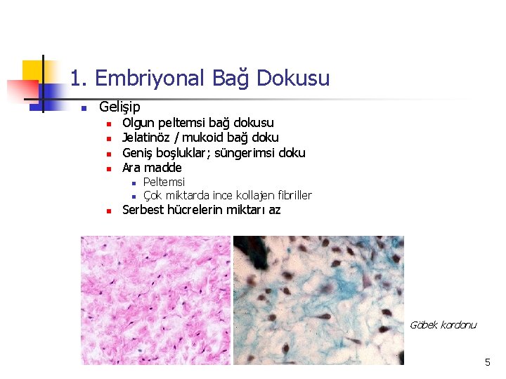 1. Embriyonal Bağ Dokusu n Gelişip n n Olgun peltemsi bağ dokusu Jelatinöz /